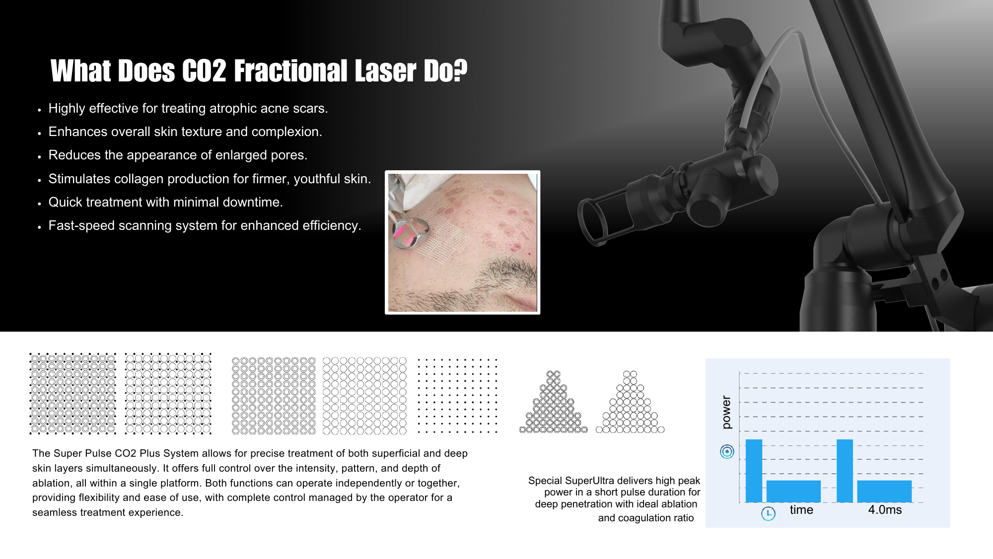 CarbonX CO2 Laser articulated arm and professional handpiece system